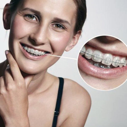 ORTHODONTIE